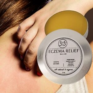 Eczema & Psoriasis All Natural Salve